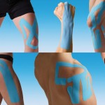 kinesiotape2